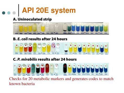 API and RAPID ID For Microbial Identification.
